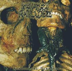 Katedra Patologii : Anatomical Disaster